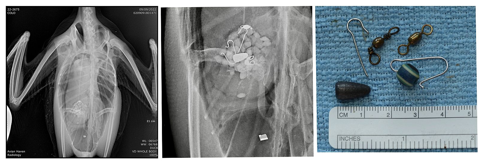 2 X-rays and a collection of lead tackle removed from a dead loon.